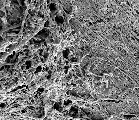 Bacteria-Biofilm-on-Used-Floss_large.jpg Bacteria-Biofilm-on-Used-Floss_large.jpg